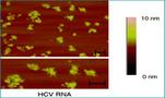 HCV RNA