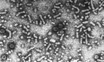 hepatitis B virus